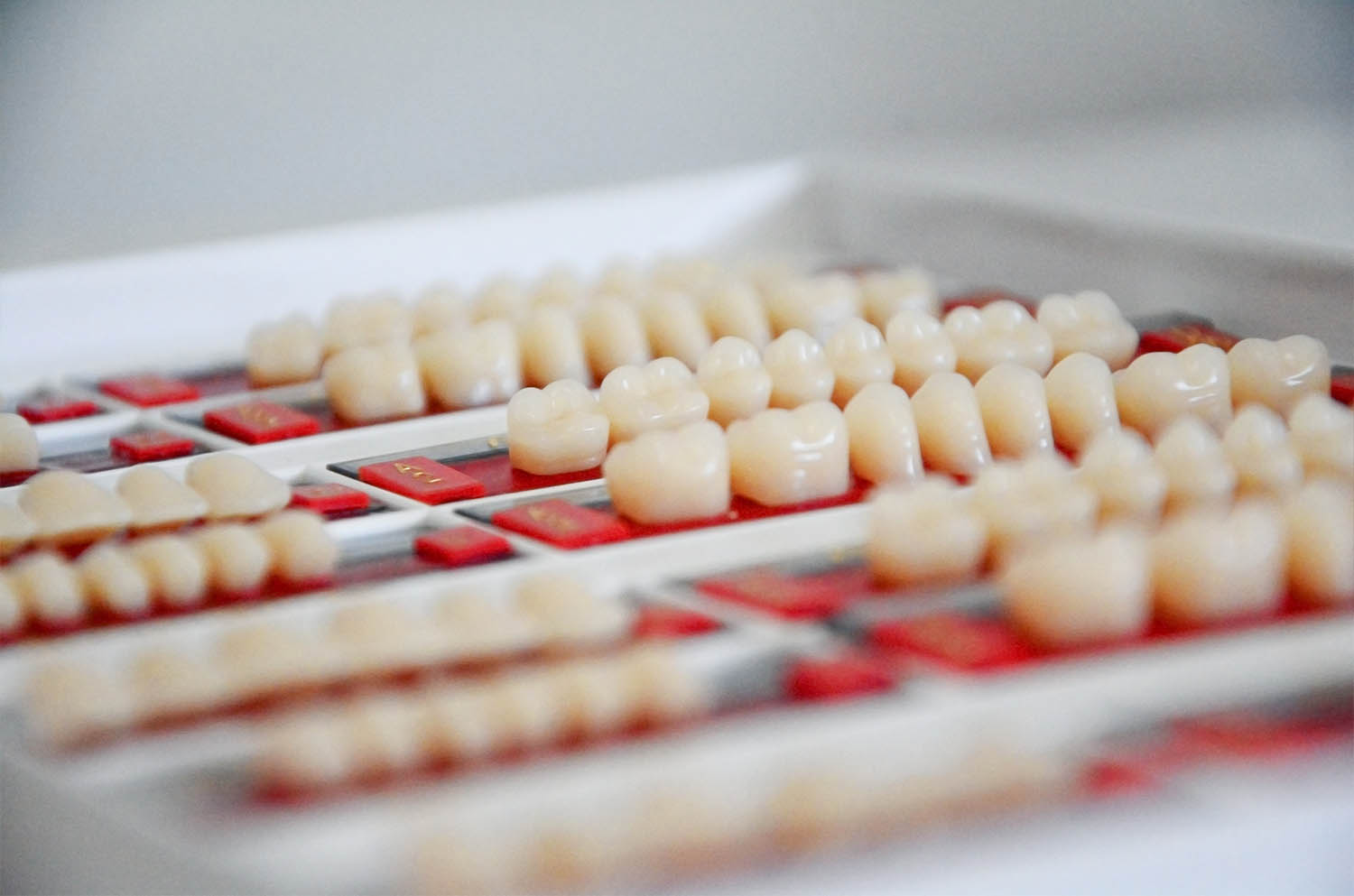 kronen bruggen implantaten en prothetiek - Dental Esthetics tandheelkunde Sterrebeek