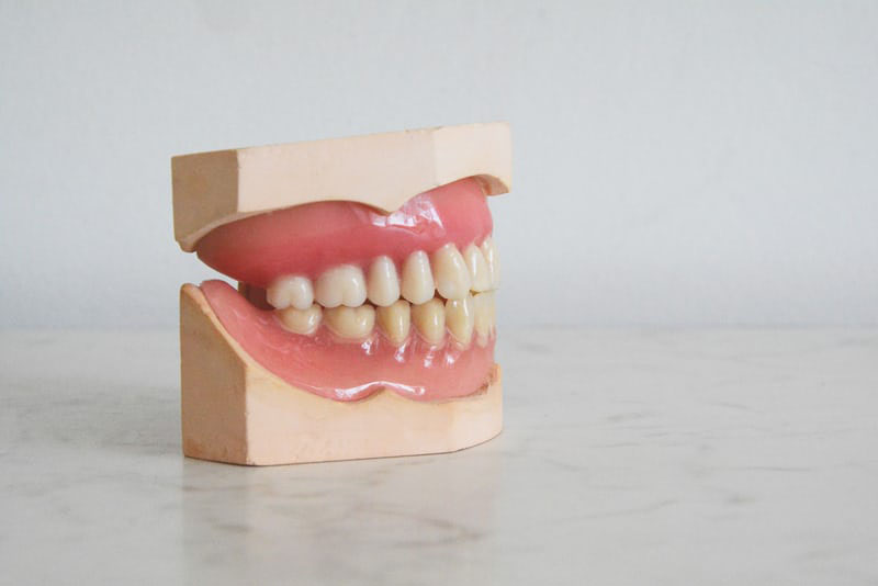 kronen bruggen implantaten en prothetiek - Dental Esthetics tandheelkunde Sterrebeek